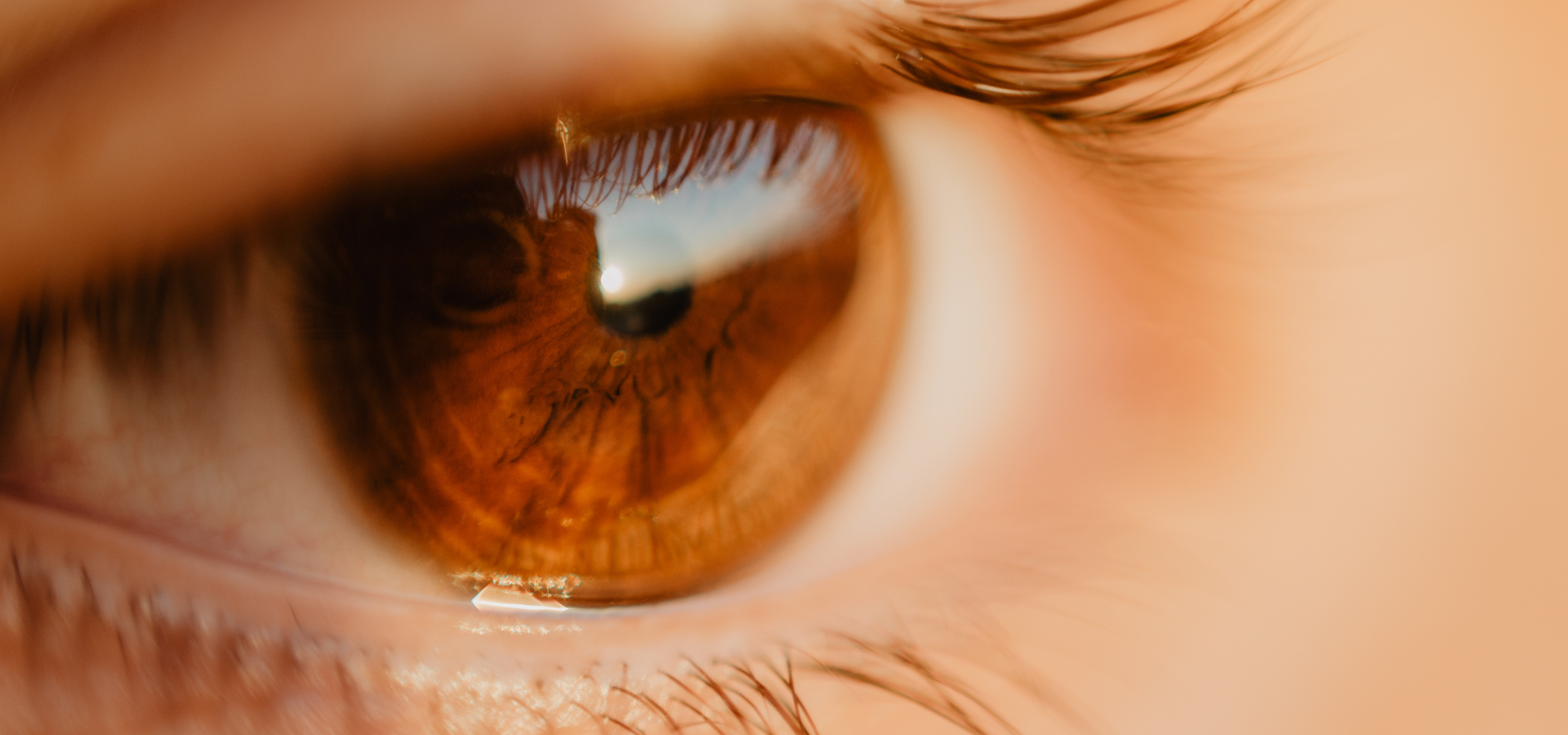 Detalle de cirugía de cataratas con lente intraocular en IOCSL